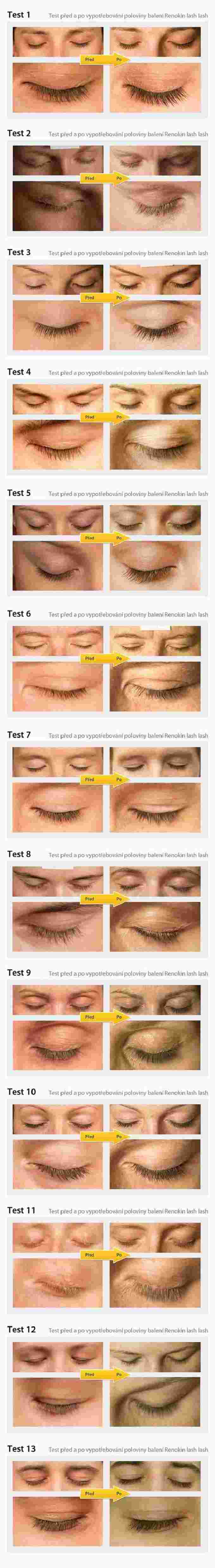 Renokin lash lash výsledky recenze