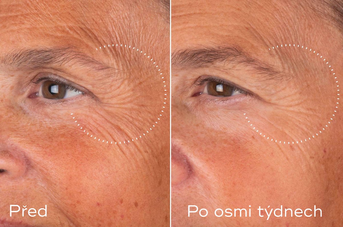 LIQUID PEPTIDES ADVANCED MP