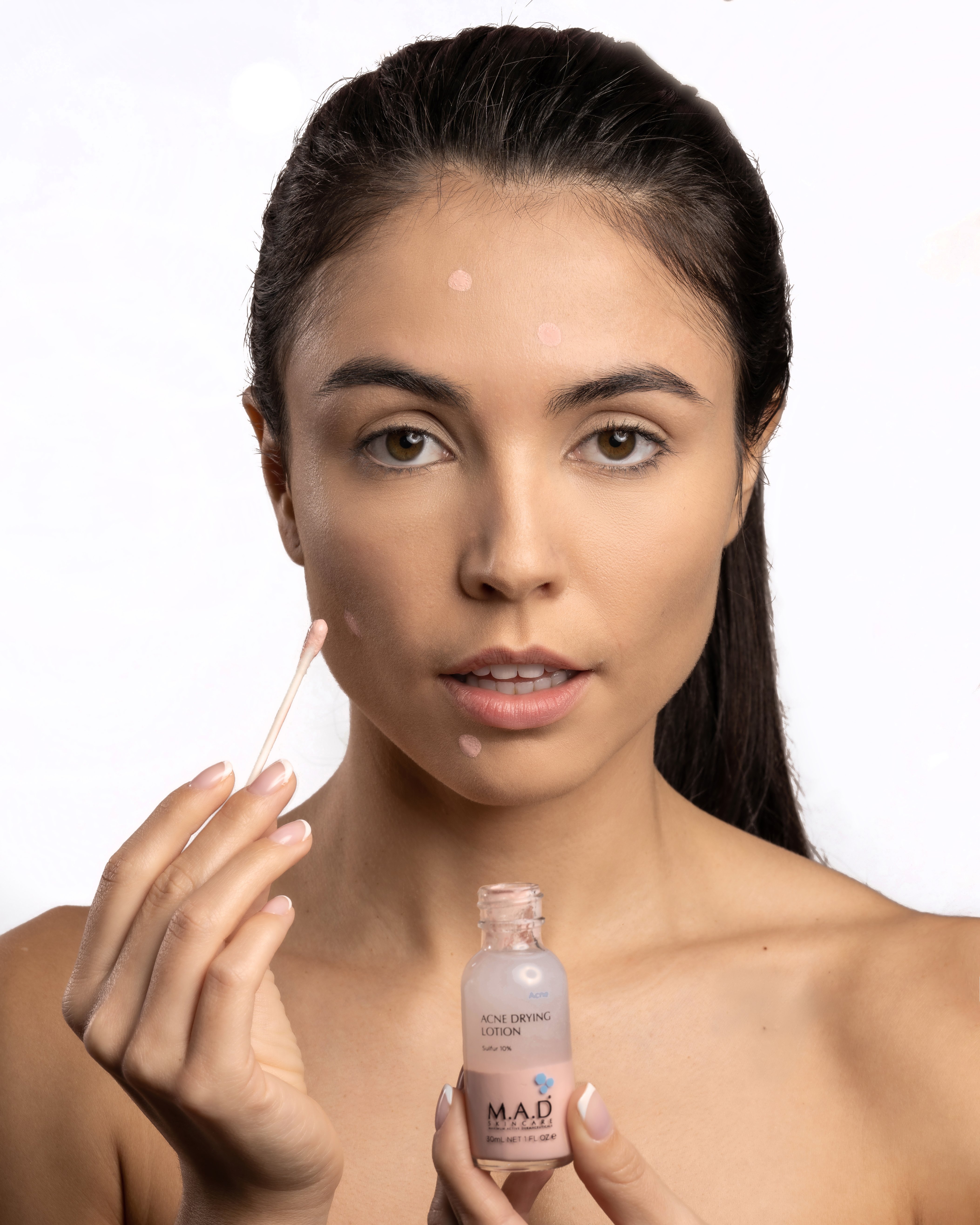 ACNE DRYING LOTION