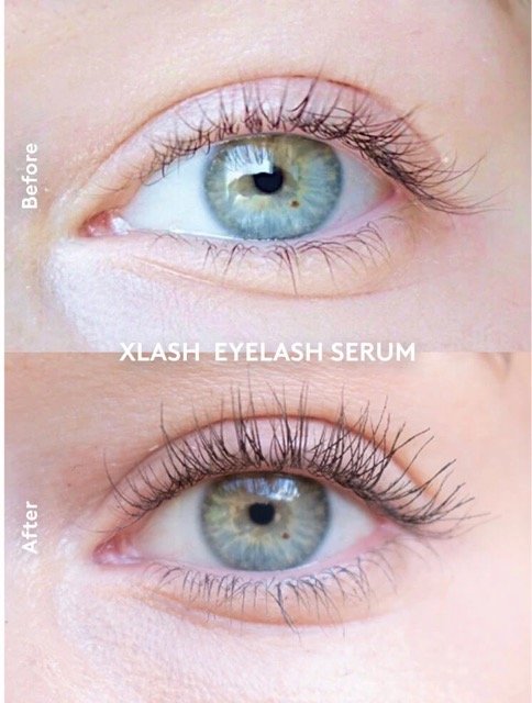 Xlash Eyelash Serum (3 ml)