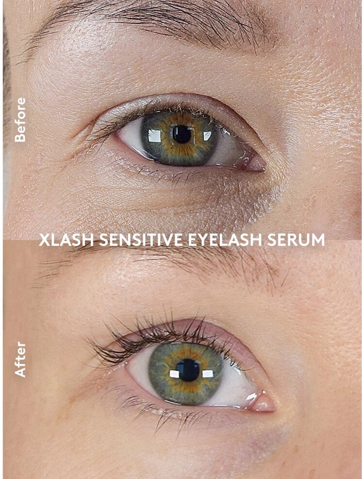 Xlash Sensitive Eyelash Serum (1 ml)