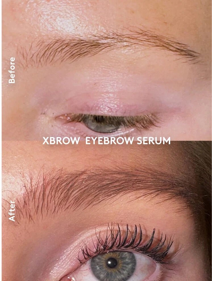 Xbrow Eyebrow Serum Xlash (5 ml)